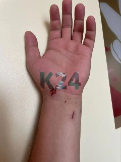 Молния поразила группу туристов в Ергаках: пострадавшие и последствия